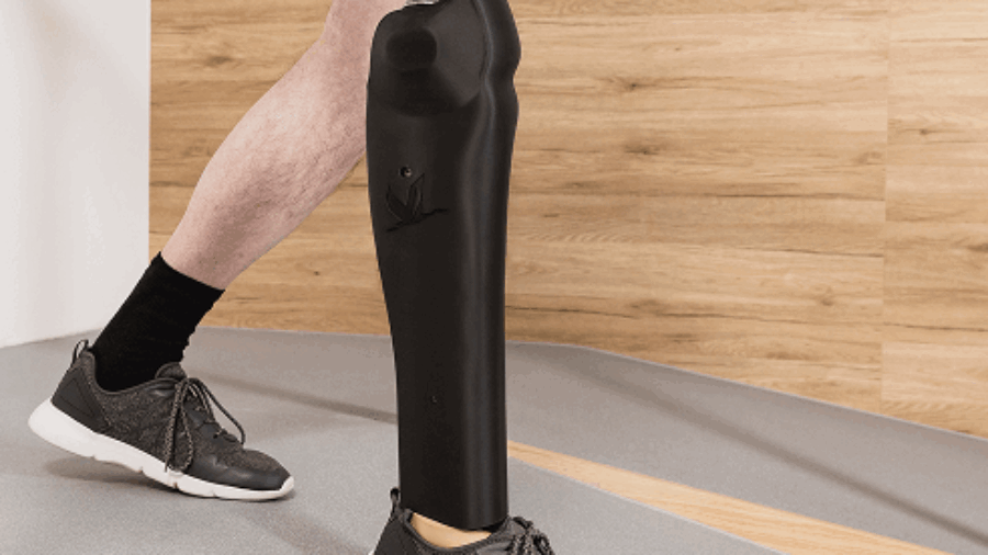 so-smart-geht-mechanisch